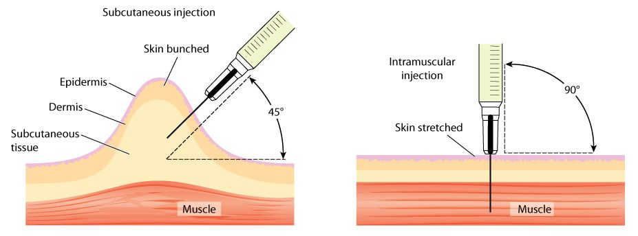 How to inject testosterone. Subcutaneous and intramuscular injections.